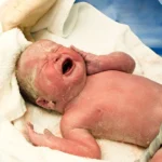 Vernix Caseosa