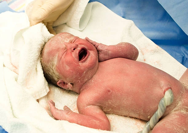 वर्निक्स केसियोसा (Vernix Caseosa): नवजात शिशु की त्वचा की प्राकृतिक सुरक्षा परत