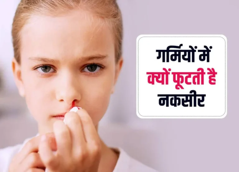 गर्मियों में नकसीर (नाक से खून आना) की समस्या: कारण, उपाय और सावधानियाँ