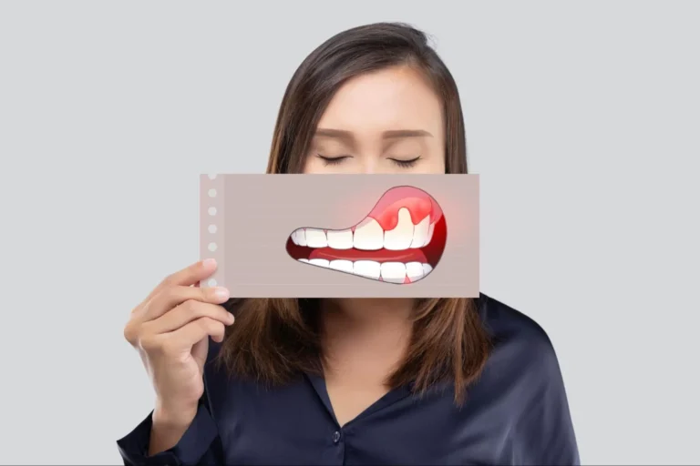 पायरिया से छुटकारा पाने के घरेलू उपाय: मसूड़ों की सेहत के लिए अपनाएं ये आसान नुस्खे